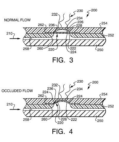 occlusion-detection
